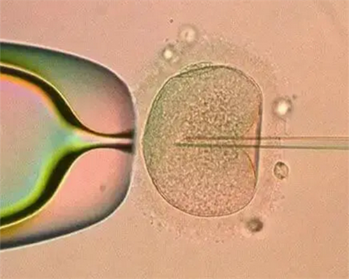 上海供卵咨询问题,【上海做供卵试管】备孕三个月，八月十六排卵，，谢谢，