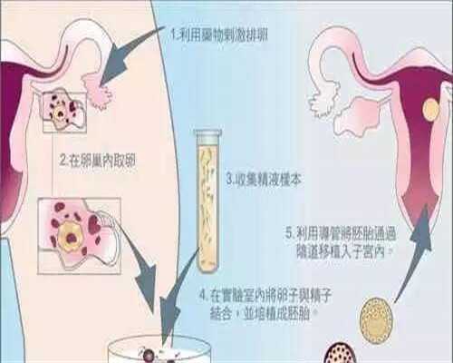 上海代怀公司供卵,情绪的变化也会影响试管婴儿的成功率吗？_上海供卵试管生