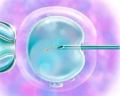 上海代生得子,试管知识|美国试管婴儿技术可以解决无精症吗?-上海供卵试管公