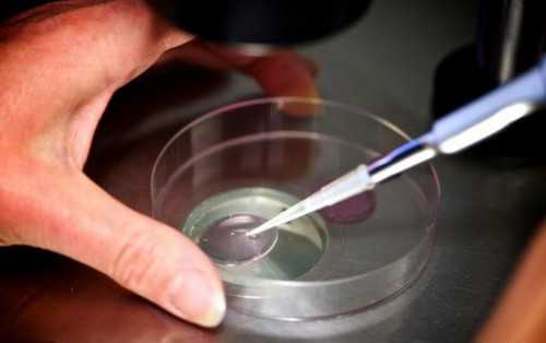 有供卵试管的姐妹吗&找人代生孩子触发吗,备孕期吃叶酸注意事项多不多