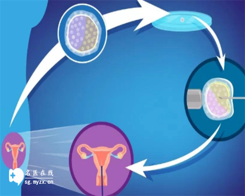 有盆腔积液影响怀孕吗？