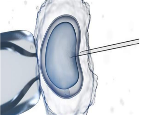 女性不孕不育可以挂哪个科室？