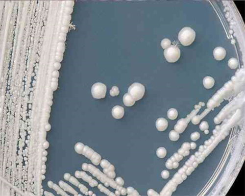 怀孕初期能吃石膏黑枣
