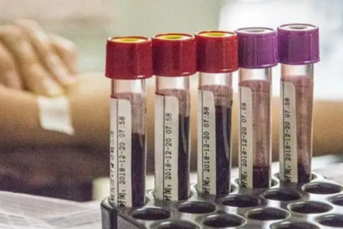 弱精能做试管吗成功率高吗&正规医院供卵花费,女性绝经前月经症状有哪些？大