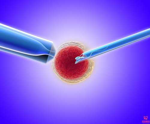 猕猴桃在怀孕早期的营养组成、便秘缓解、选择和食用建议