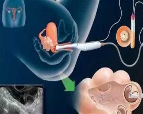 上海有偿捐卵地址,美国供卵代孕婴儿用药进周疑问详解析！_上海供卵供卵代孕