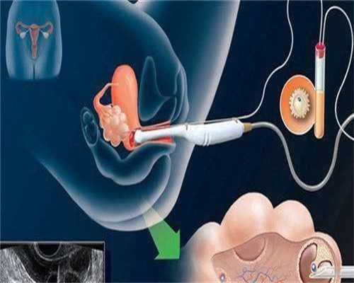 44岁绝经了还能试管吗&供卵华中卵子库,70后、80后最佳助孕之路——美国试管婴