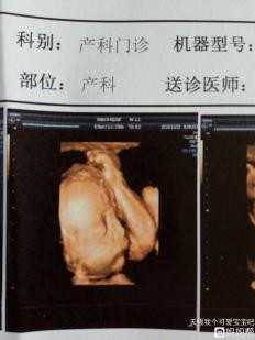 代孕防治孕吐食疗方_上海环球宝贝代孕正规吗