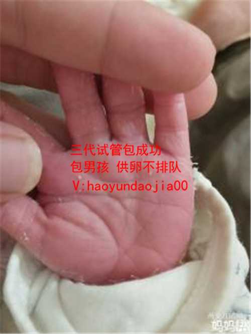 上海能做供卵试管医院_口碑好供卵试管价格_怀孕检查是否包括艾滋病？