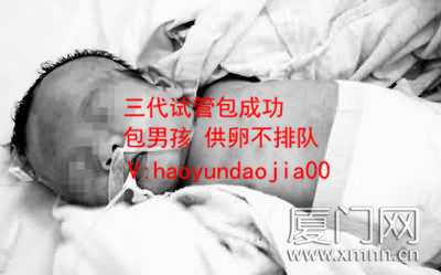 上海做供卵试管婴儿哪家好_上海做供卵试管要具备什么条件_男性精子DNA碎片检