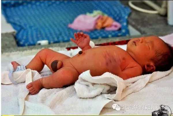 上海女找男人代孕_上海2021私人找人代孕_AA69上海地址-输卵管只通一边可以直接