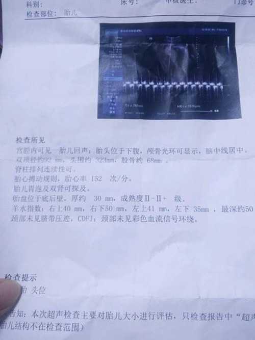 上海包头代孕代怀孕_上海想找代孕 怎么_南方39生殖-如果胎儿位置不好并且不能